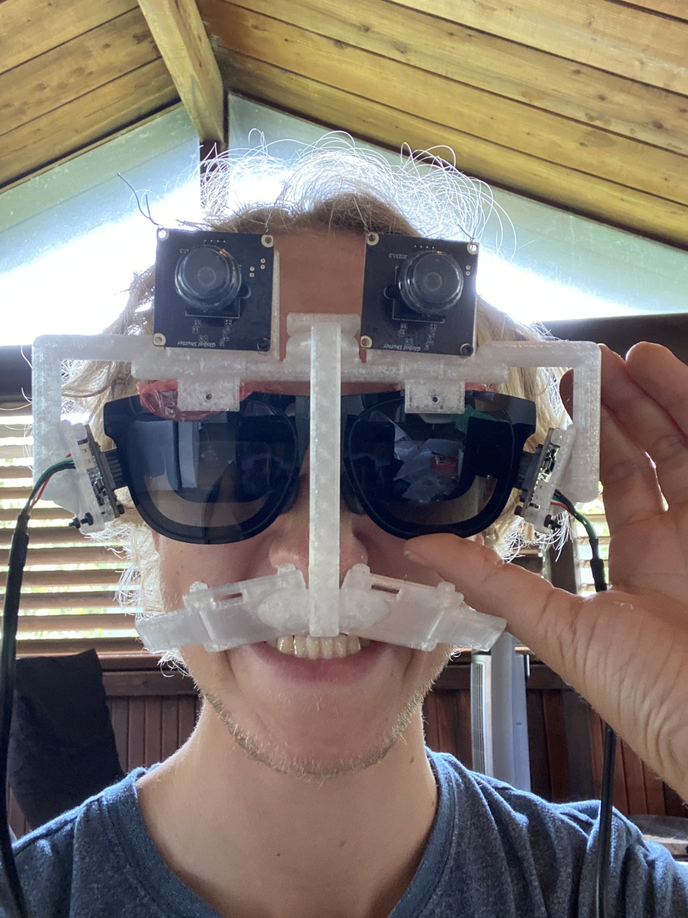 Dylan wearing the rig: two world cameras on the printed carrier above the glasses, an eye camera on a boom at each temple, cables running back